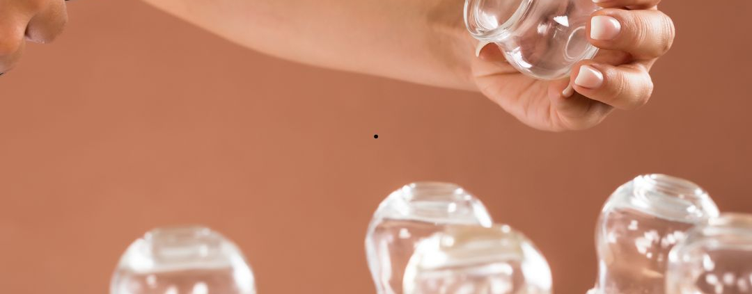 Cupping Therapy in Adelaide