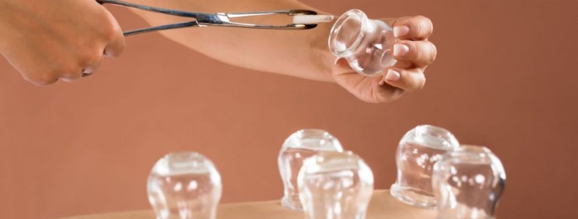 Cupping Therapy in Adelaide