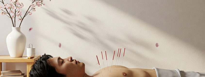 acupuncture and dry needling