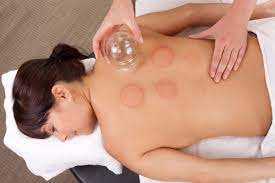 Headaches Cupping Therapy