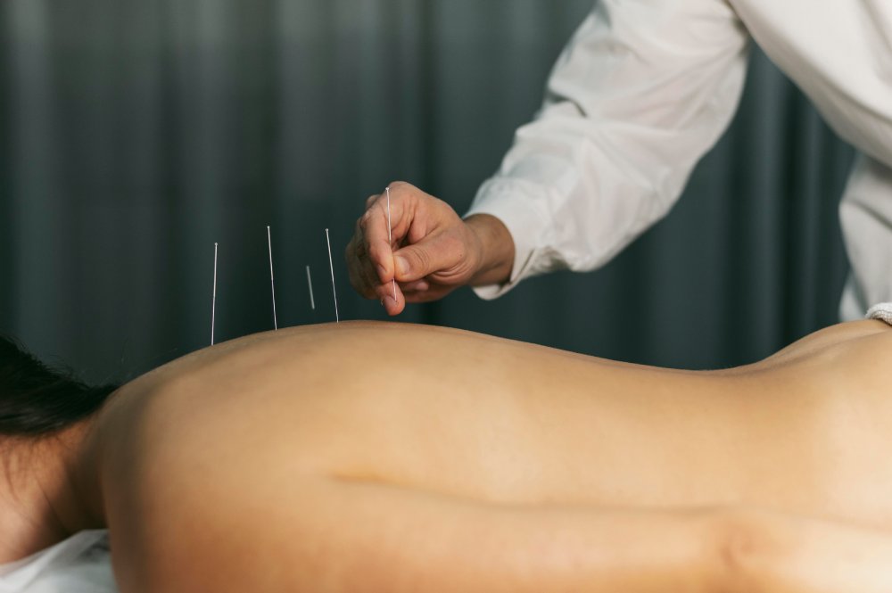 acupuncture process 1