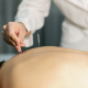 Acupuncture Costs Adelaide