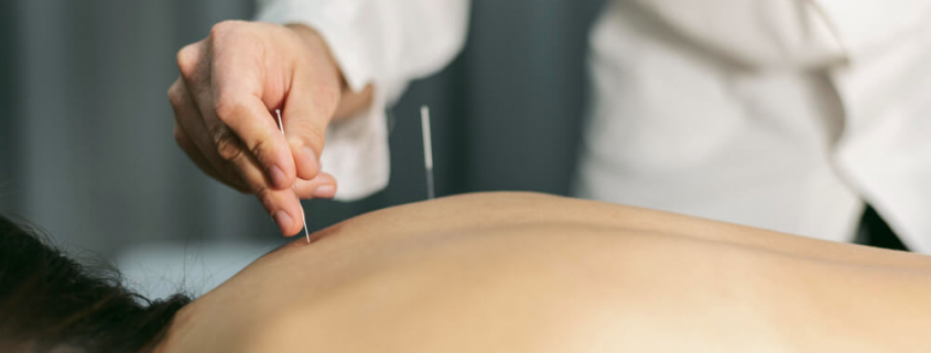 Acupuncture Costs Adelaide