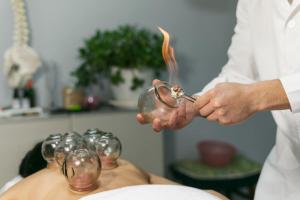 The Benefits of Cupping for Muscle Tension and Recovery