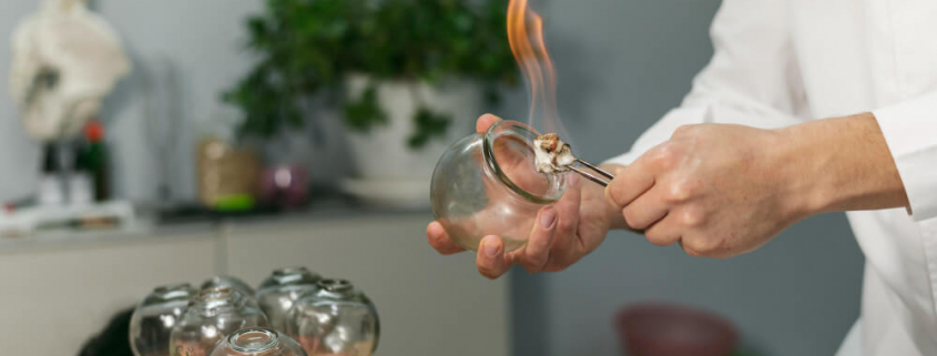 Cupping for Muscle Tension